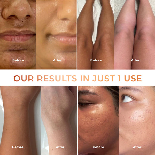 De-Tan Scrub โ Tan Removal & Brightening Face & Body Scrub