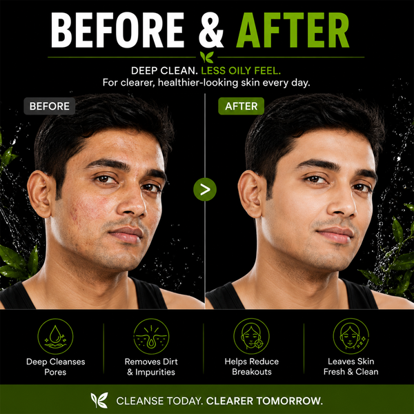 Anti Acne Face Wash