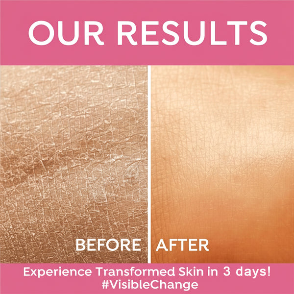 Fruit Moisturizing Cream – Fruity Glow & Daily Hydration Care | Kokakoshi