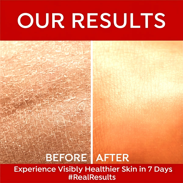 Malai Kesar Moisturizing Skin Cream – Soft, Glowing & Nourished Skin | Kokakoshi