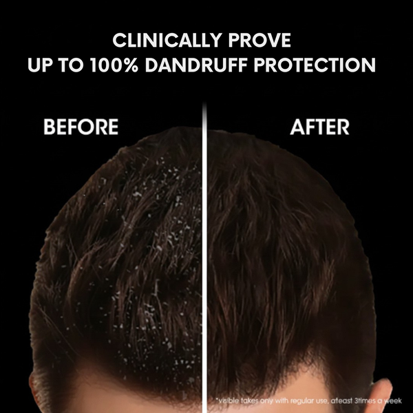 Herbal 12 Ayurvedic Herbs Hair Fall Control & Dandruff Care Shampoo | Kokakoshi